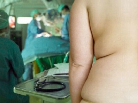 Cảnh báo khi mổ cho người béo phì